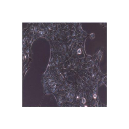 Human Papillary Thyroid Carcinoma Cell Lines, #TPC-1