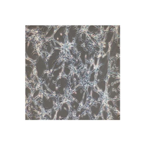 Astroglilastoma Of The Human Brain, #U118MG(U-118MG)