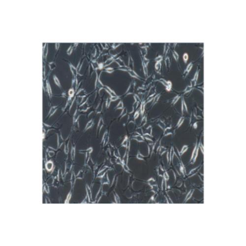 Human Osteosarcoma Cell Line, #SAOS-2