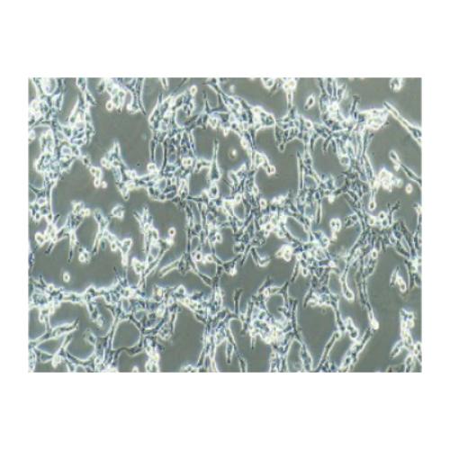 Human Population With Highly Metastatic Lung Cancer Cell Line, #95-D