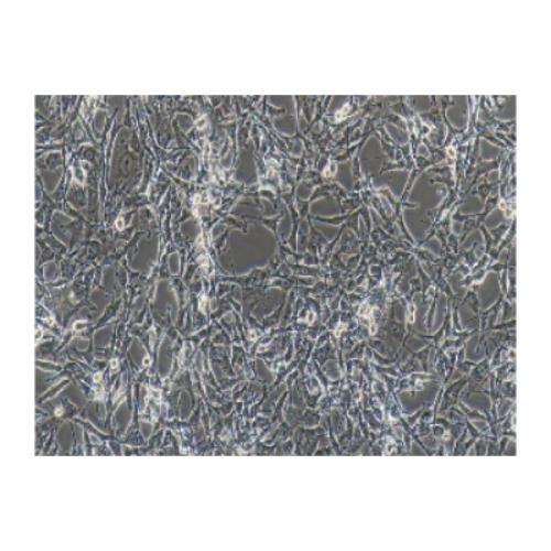 Human Glioblastoma Cell Line, #A172