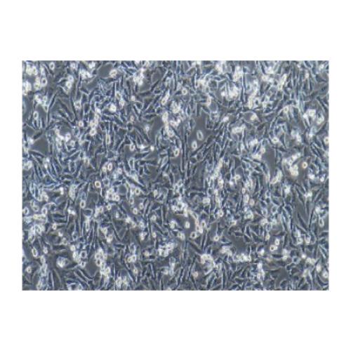 Human Malignant Melanoma Cell Line, #A375