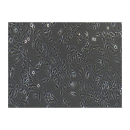 Human Lung Cancer Cell Line, #A549