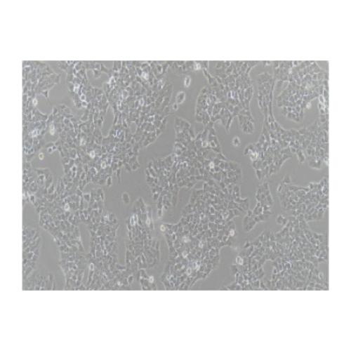 Human Rhabdomyoma Tumor Cell Line, #A673