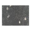 Human Melanoma Cell Line, #A875