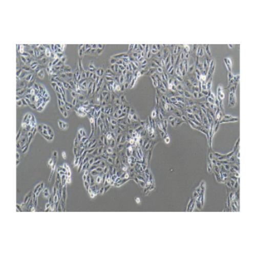 Human Renal Cell Adenocarcinoma Cell Line, #ACHN