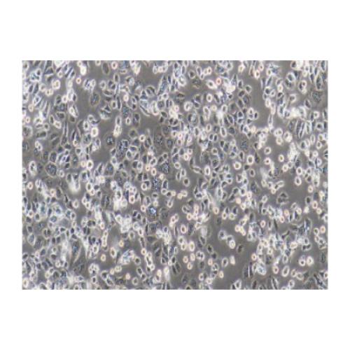 Human Gastric Adenocarcinoma Cell Line, #AGS