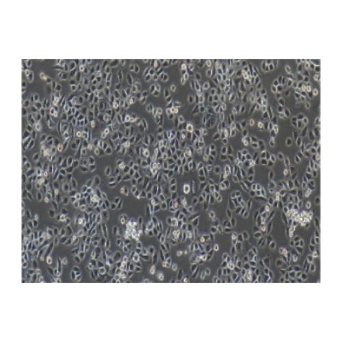 Human-Metastasized Pancreatic Adenocarcinoma Cell Line, #ASPC-1?