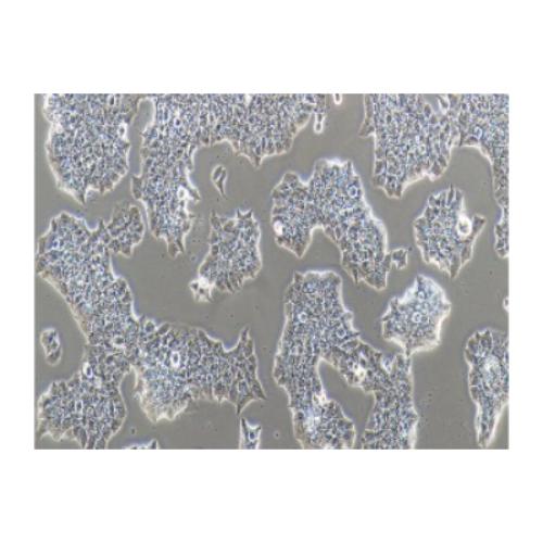 Human Breast Ductal Cancer Cell Line, #BT-474