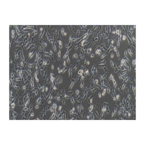 Human Breast Ductal Cancer Cell Line, #BT-549