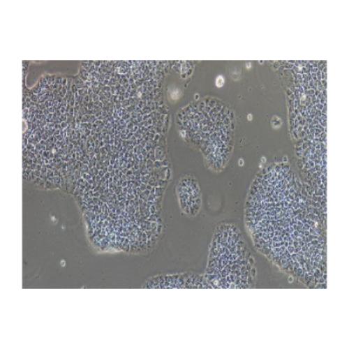 Human In Situ Pancreatic Adenocarcinoma Cell Line, #BXPC-3