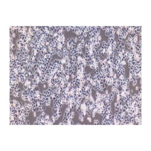 Human Cervical Carcinoma Cell, #C-33A