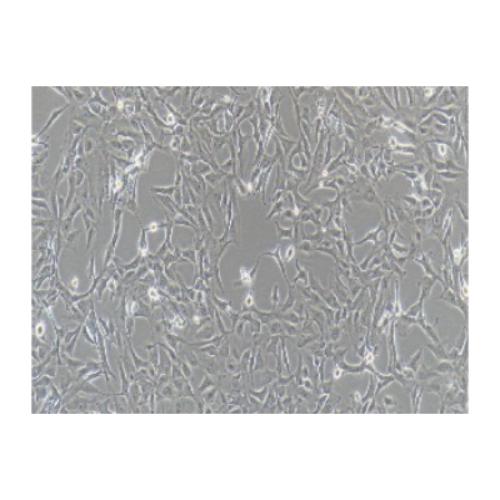 Human Lung Cancer Cell Line, #CALU-1