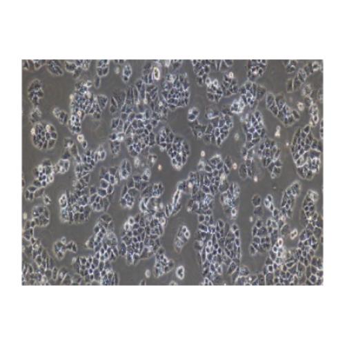 Human Ovarian Adenocarcinoma Cell Line, #CAOV-3