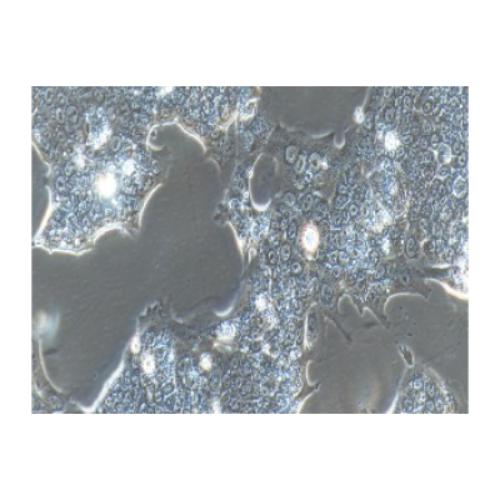 Human Pancreatic Cancer Cell Line, #CAPAN-1