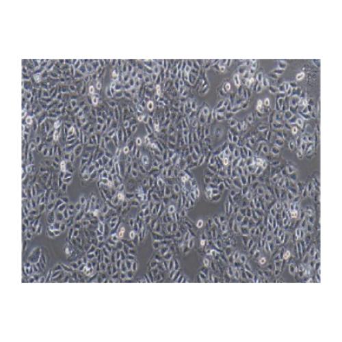 Human Cervical Carcinoma Cell, #CHANG LIVER