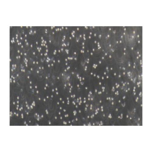 Human Ovarian Cancer Cell Line, #COC1