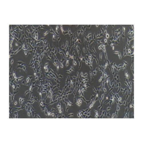 Human Ovarian Clear-Cell Carcinoma Cell Line, #ES-2