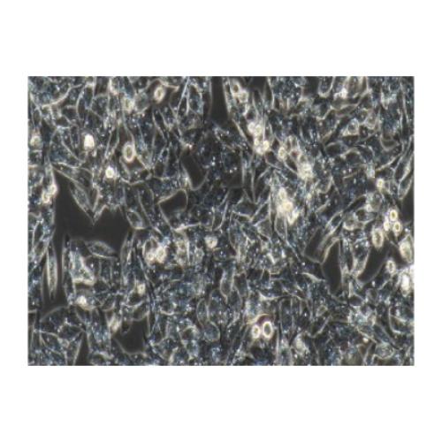 Human Gastric Mucosal Epithelial Cell Line, #GES-1