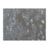 Human Non-Small-Cell Lung Cancer Cell Line, #HCC827