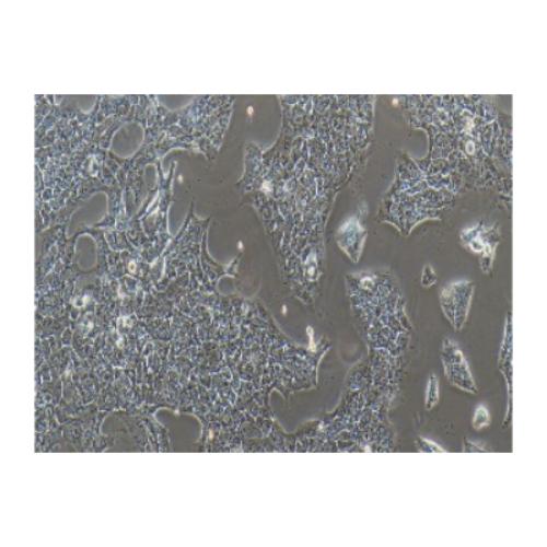 Human Non-Small-Cell Lung Cancer Cell Line, #HCC827