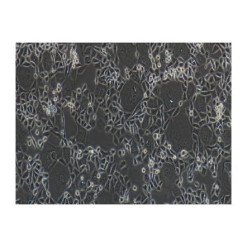 Human Colon Cancer Cell Line, #HCT-15