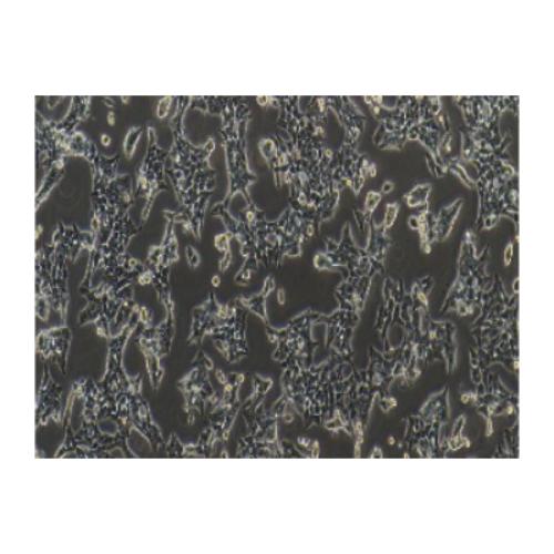 Human Colon Cancer Cell Line, #HCT116