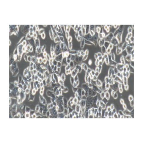 Human Colorectal Cancer Cancer Cell Line, #HCT-8