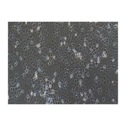 Human Endometrial Adenocarcinoma Cell Line, #HEC-1-A