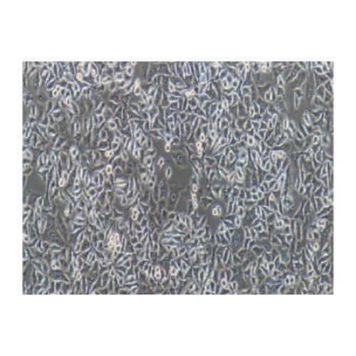 Human Cervical Carcinoma Cell, #HELA.S3