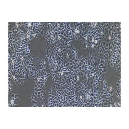 Human Highly Metastatic Ovarian Cancer Cell Line, #HO-8910PM