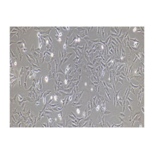 Human Osteosarcoma Cell Line, #HOS