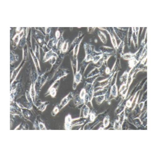 Human Glioma Cell Line, #HS683