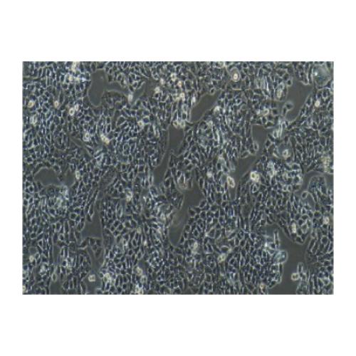 Human Colon Cancer Cell Line, #HT-29 (HT29)