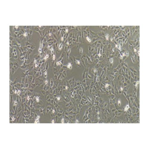 Human Fibrosarcoma Cell Line, #HT-1080