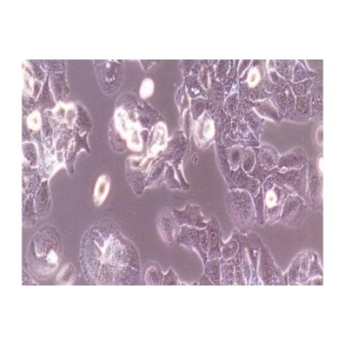 Human Bladder Cancer Cell Line, #HT-1376