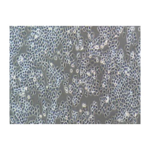 Human Normal Ovarian Epithelial Cell Line, #IOSE-80
