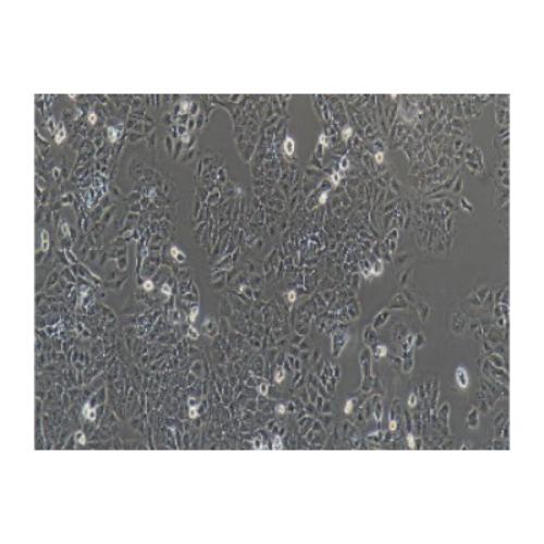 Human Endometrial Cancer Cell Line, #ISHIKAWA