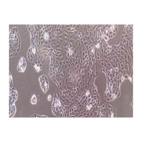 Human Pancreatic Cancer Epithelial Cell Line, #PANC 05.04