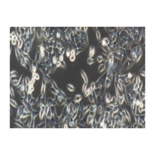 Human Ovarian Adenocarcinoma Cell Line, #OVCAR-3