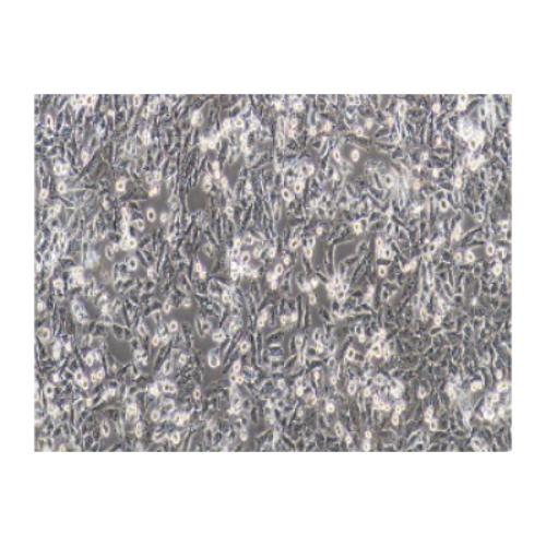 Human Lung Cancer Cell Line, #NCI-H1703