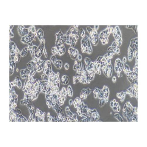 Human Lung Adenocarcinoma Cell Line, #NCI-H1395