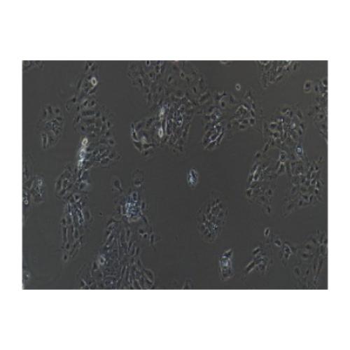 Human Lung Cancer Cell Line (Lymph Node Metastasis), #NCI-H292