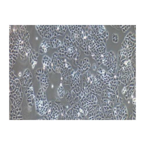 Human Lung Cancer Cell Line, #NCI-H23