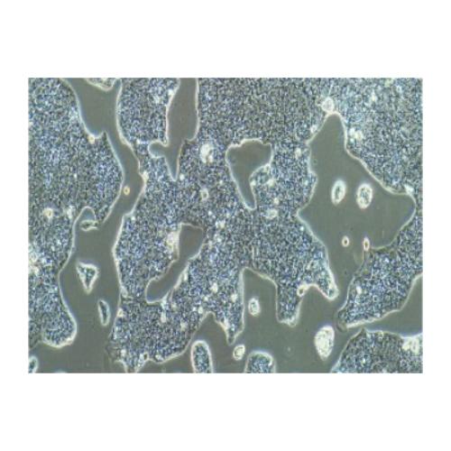 Human Gastric Carcinoma Cell, #NCI-N87
