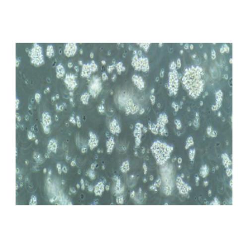 Human Acute Lymphoblastic Leukemia Cell Line, #MT-4