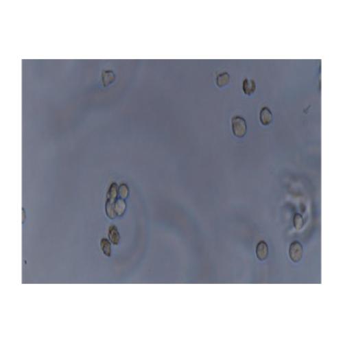 Human Acute Lymphoblastic Leukemia Cell Line, #MOLT-4