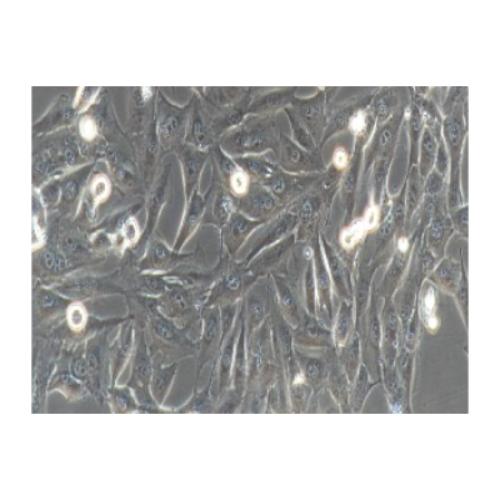 Human Osteosarcoma Cell Line, #MG63