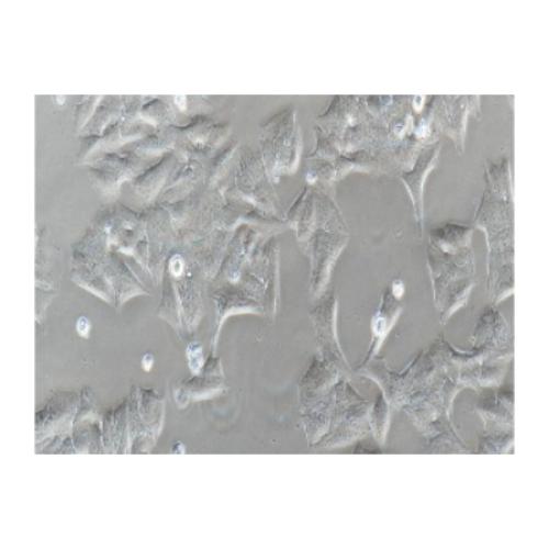 Human Breast Cancer Cell, #MDA-MB-361