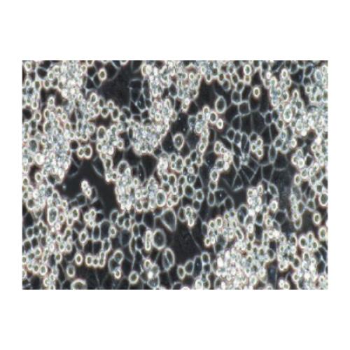 Human Breast Cancer Cell, #MDA-KB2